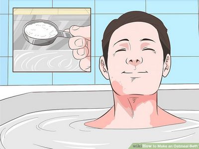 How to Get Sunburn Relief Now